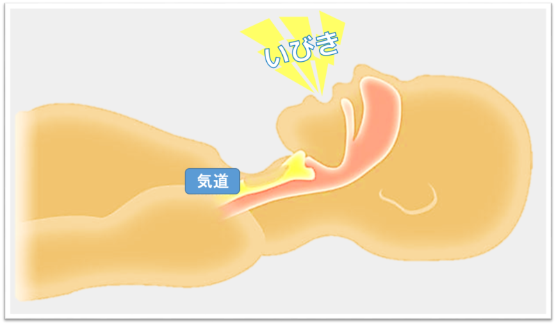 YOKONE3 いびき防止 横向き寝を促す 呼吸がしやすい